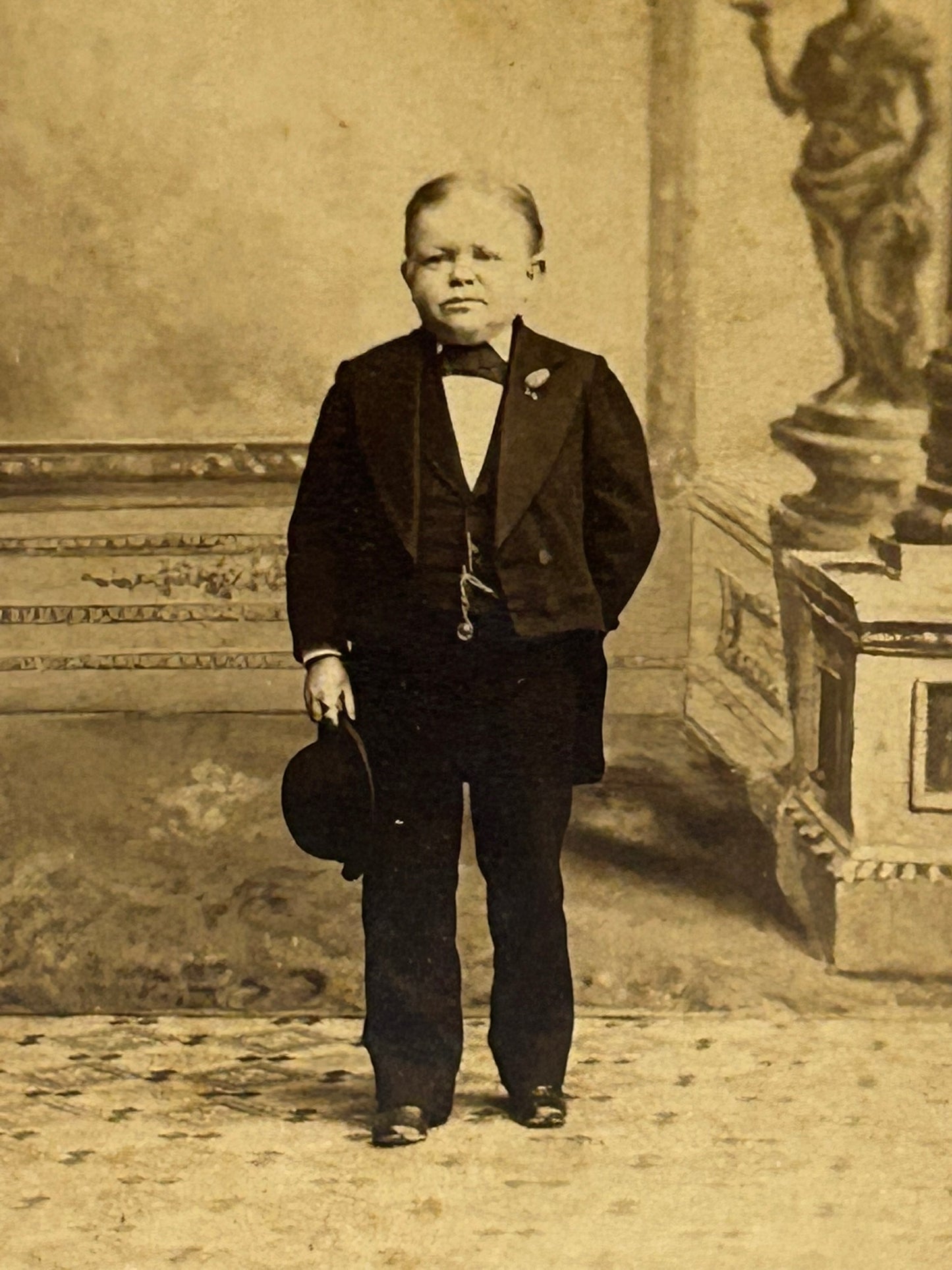 ANTIQUE CDV PHOTOGRAPH OF MIDGET